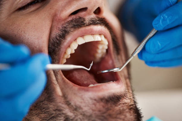 Best Oral Cancer Screening  in Juarez, TX
